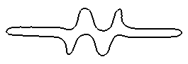 circumference of stent cell